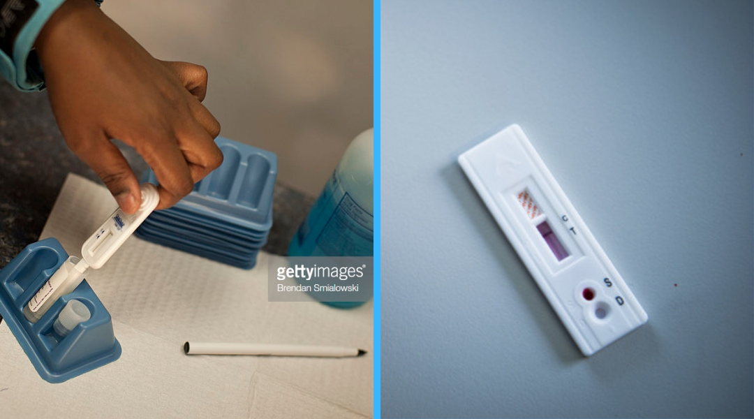 Right is a fingerstick test for HIV and the left is a oral fluid swab submerged in fluid